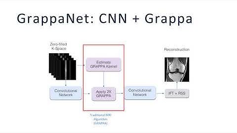 GrappaNet: Combining Parallel Imaging With Deep Learning for Multi-Coil MRI Reconstruction