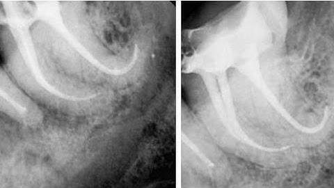3  - IDEC - 2025 - Curved Canals