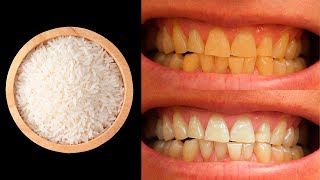 Bleichen und reinigen Sie Ihre Zähne in 1 Minute! Befreien Sie sich von Zahnstein!