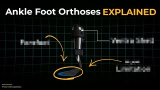 Ankle Foot Orthoses EXPLAINED: Instantly Understand Any AFO Design!
