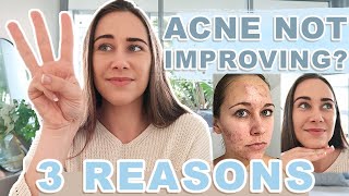 3 reasons your CYSTIC ACNE is NOT getting better!! & How to clear acne NATURALLY... by Madison Dohnt 29,206 views 3 years ago 10 minutes, 20 seconds