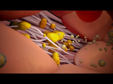 Vídeo: Colesterol Alt En Gats