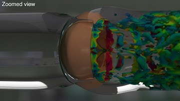 Heart valve isogeometric FSI analysis with the space–time topology change method