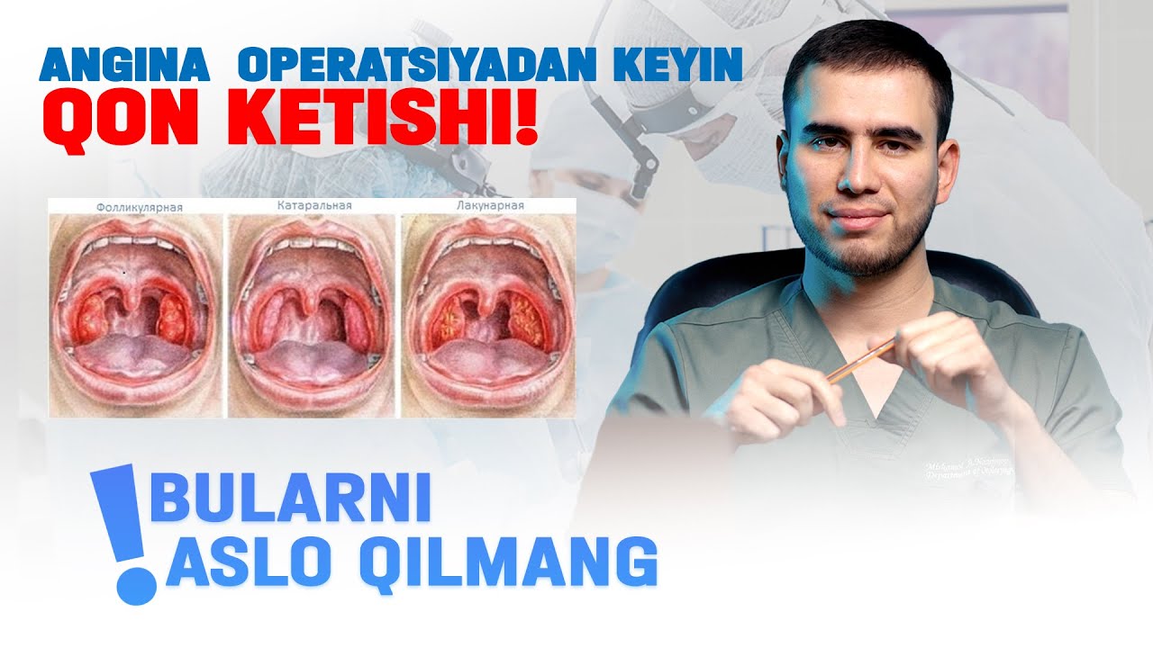 ANGINA OPERATSIYASIDAN KEYIN QON KETISHI! | BULARNI ASLO QILMANG :☎️951888688