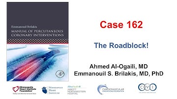 Case 162: Manual of PCI - The "roadblock"