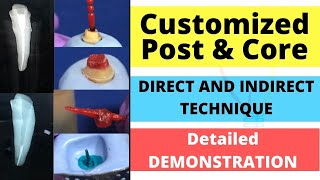 Customized Post and Core Demonstration - Direct and Indirect Technique