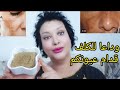 My aunt gave it to me Removes dark spots from the face neck and melasma Removes 20 years of  mp3