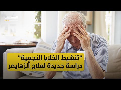 دراسة اكتشاف آلية جديدة لتطوير علاج لمرض ألزهايمر عبر تنشيط الخلايا النجمية
