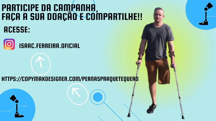 SAIBA MAIS SOBRE A MINHA AMPUTAO!!!