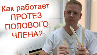 Как работает протез полового члена? / Доктор Черепанов