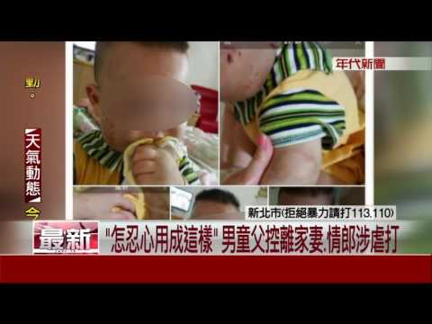 母攜子會男友人 1歲童疑受虐遭毆渾身傷