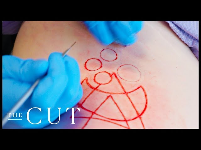 How to prevent Scarring from a scratch on a still healing tattoo :  r/sticknpokes