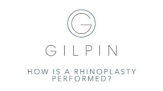 How Is A Rhinoplasty Performed? | Dr. David Gilpin