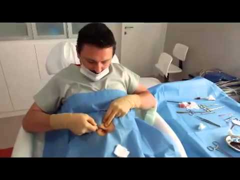 Oygar Aytekin kendi kendini ameliyat ediyor...