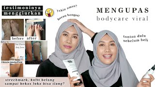 Honest Review 1 Bulan Pake D'Savior - Ngaruh Gak Ya Hilangkan Kulit Belang sampai Strechmark ??