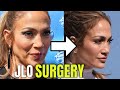 Jennifer Lopez: Plastic Surgery (2020)