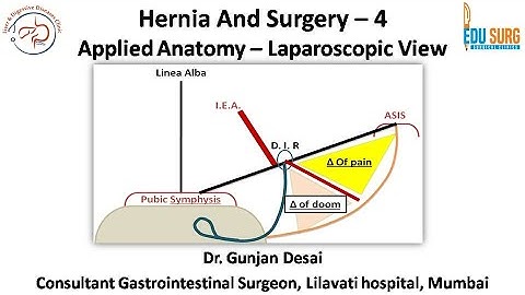 Mastering Hernia Surgery - 4: Applied anatomy for Laparoscopic Inguinal hernia - Edusurg Clinics