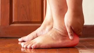 Find Relief And Get Back On Your Feet With Heel Pain Solutions In Pinellas Park