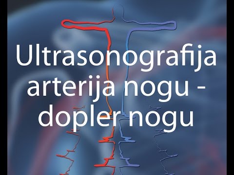 Dopler indeksi - Ultrasonografija arterija nogu - dopler nogu