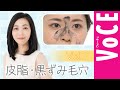 【皮脂・黒ずみ毛穴に効く！】水井真理子さんが教えるスキンケアのコツ vol.1