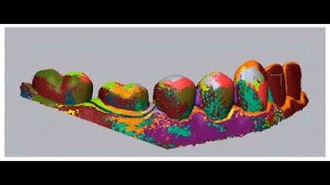 Part 1 - Scanning with the Trios 4