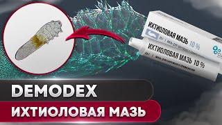 Ихтиоловая мазь против клеща | Угревая Железница Demodex