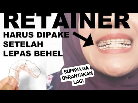  Perawatan  Pasca Behel  Bracket Kawat Gigi Retainer YouTube