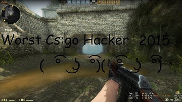 -Overwatch Edit- Worst CS:GO Hacker Ever