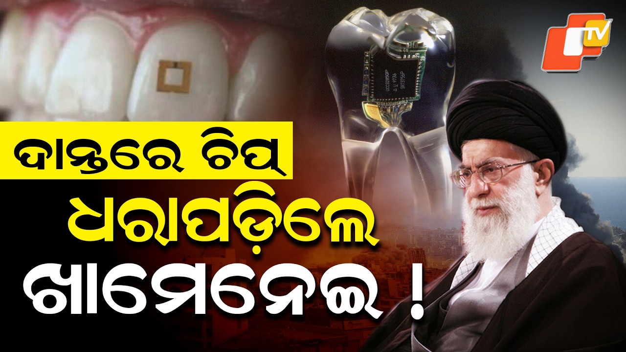 “Spy Dental Chips ? Did Israel Track Ali Khamenei Through Tooth Implants? | Fact or Conspiracy”
