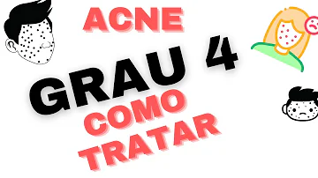 Como tratar a acne grau 4?