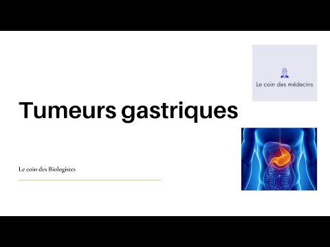 Vidéo: Incidence Et Facteurs De Risque De Délire Subsyndromal Après Résection Curative D'un Cancer Gastrique