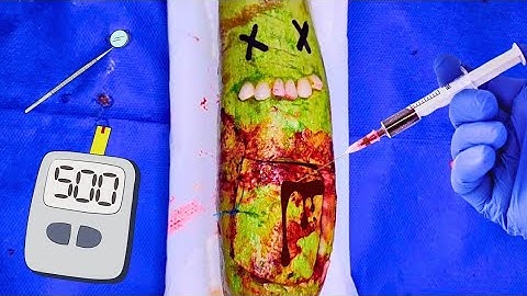 CUCUMBER FUNNY ASMR SURGERY