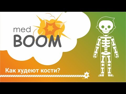 Остеопороз, витамин Д, кальций, лечение остеопороза/medBOOM