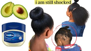 How I Used AVOCADO and VASELINE For Extreme Hair Growth and Thickness.