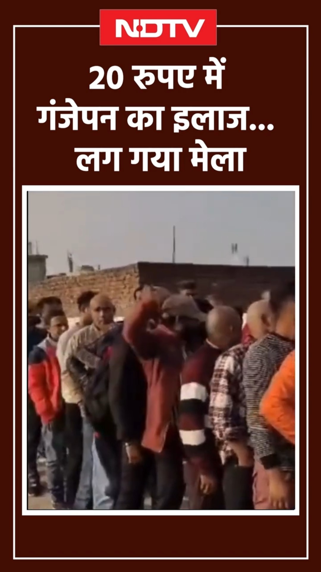 सिर्फ 20 रुपये में गंजेपन का इलाज, भीड़ देख उड़ जाएंगे होश | Viral Video | UP News | Shorts | NDTV