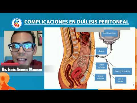 Video: Faktor Risiko Peritonitis Pada Pesakit Pada Dialisis Peritoneal Yang Berterusan Yang Menjalani Kolonoskopi: Kajian Multicentre Retrospektif