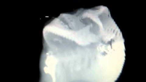 VTK Human Head Visualization 1