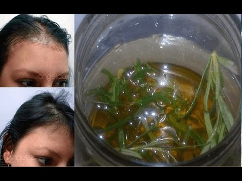 camera iphone 8 plus apk Romero para controlar la caída del cabello