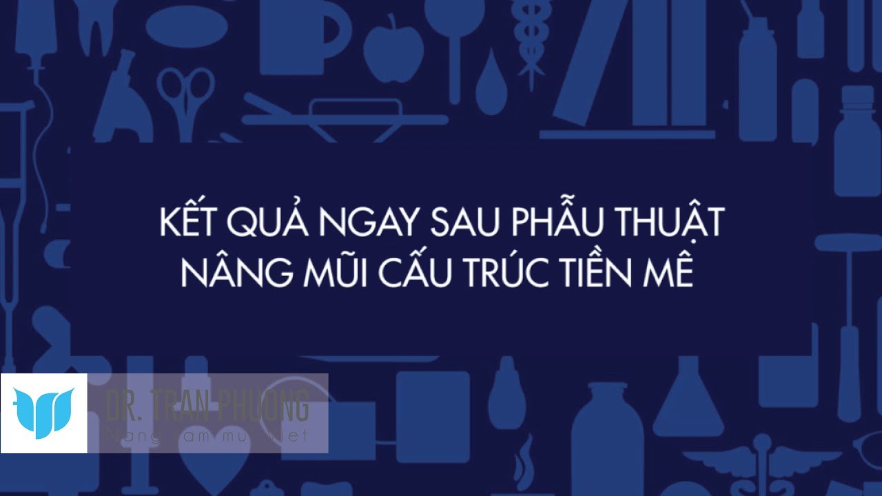 Bác sĩ Trần Phương: Kết quả nâng mũi cấu trúc tiền mê sau 60 phút