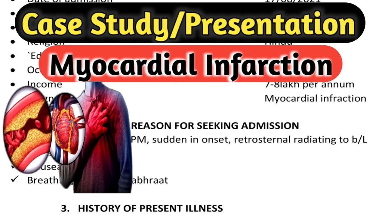 Case Study/ Presentation on Myocardial Infarction (MI) @nursingc - YouTube