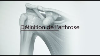 Centre De Larthrose Partie 1 Définition De Larthrose