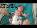 Nasogastric ( NG ) Tube Insertion In Neonate | Orogastric Tube | Feeding Tube