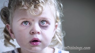 Recognition of Child Abuse and Neglect (Training Video)