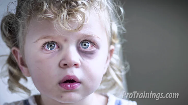 Recognition of Child Abuse and Neglect (Training Video)