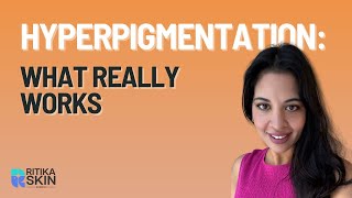 How to Treat Pigmentation Safely in Darker Skin Tones | Micro needling vs Lasers Explained