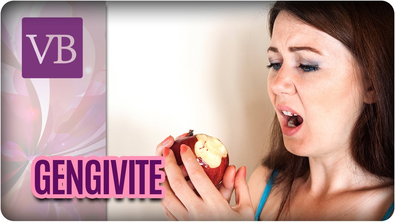 Gengivite: Sintomas, tratamentos e causas - Você Bonita (24/07/17) vida saudável herbalife