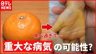 一体ナゼ？ミカン食べ過ぎて手が黄色に…　『the SOCIAL』傑作選（2017年12月19日放送より）