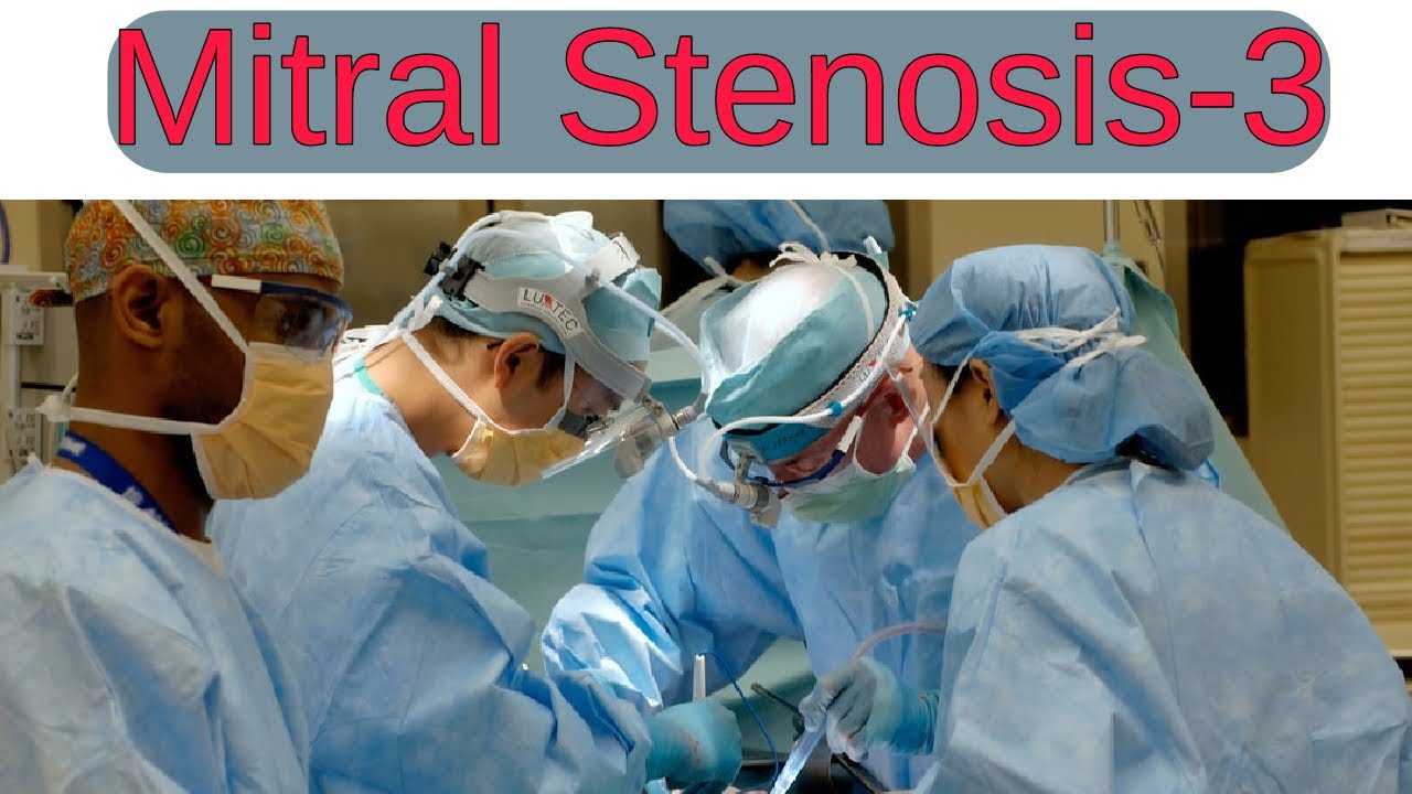 MITRAL STENOSIS Made Easy PART 3 High Yield Shorts For USMLE MCCQE1 