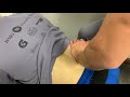 Lower back pain treatment