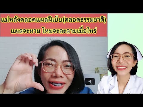 แผลฝีเย็บจะหายและไหมจะละลายเมื่อไหร่|แม่โบNurse Kids